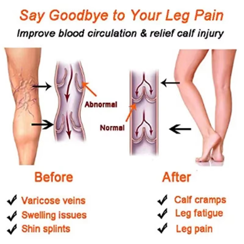 Kaus Kaki Kompresi Wanita Kaus - Compression Sleeve Calf ulasan dan harga